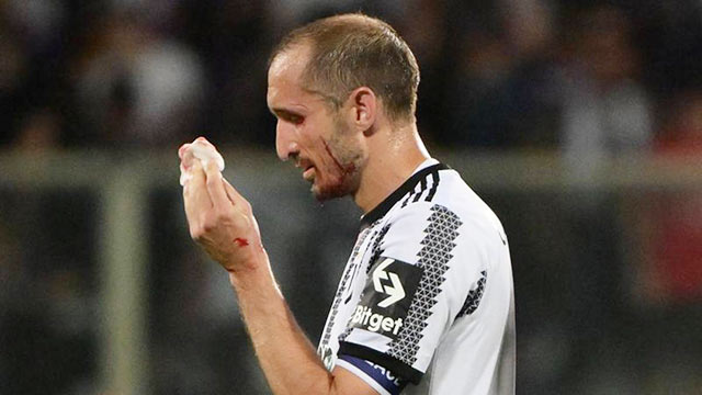 Chiellini đổ máu trong ngày chia tay Juventus