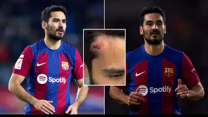 Gundogan đã phải đón giao thừa trong bệnh viện